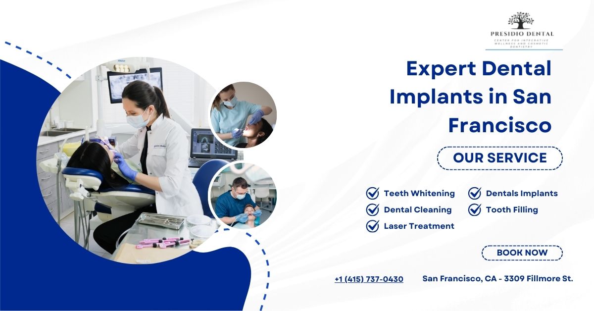 Expert Dental Implants in San Francisco
