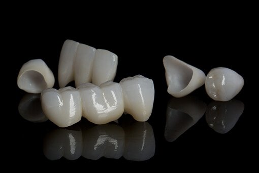 Porcelain Crown